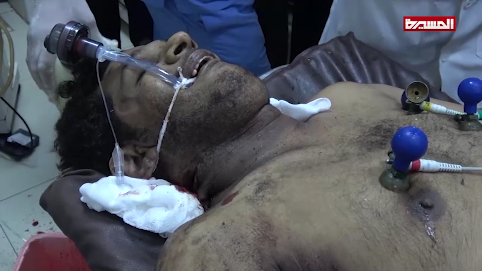 استشهاد مواطن وإصابة سبعة آخرين في قصف المرتزقة على منازل المواطنين في الحديدة