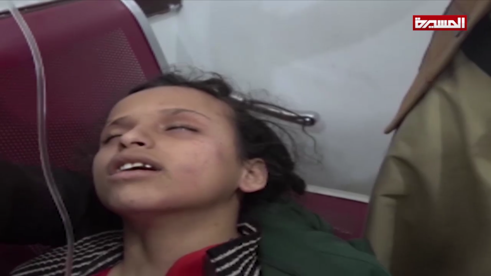 السعودية تتعمد ذبح الطفولة في اليمن وغطاء أممي يشجعها على الاستمرار