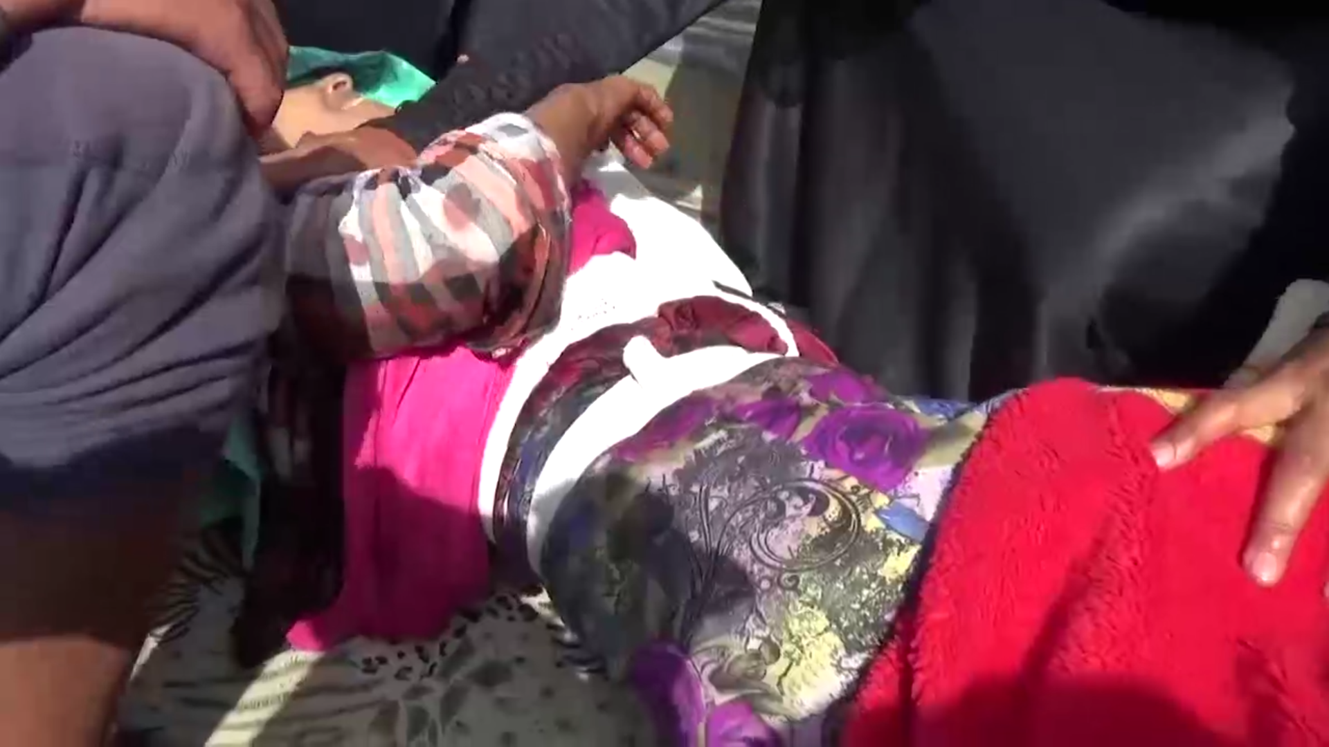 جرحى من المواطنين اثر قصف المرتزقه لمنازلهم بالمدفعية في حيفان بتعز