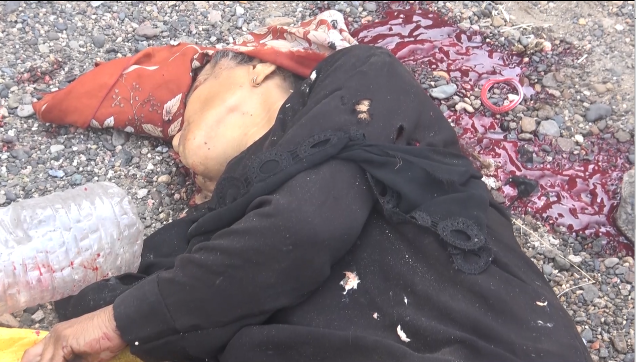الحديدة-استشهاد امرأة جراء قصف منافقي العدوان في حي 7يوليو جوار مدرسة عائشة